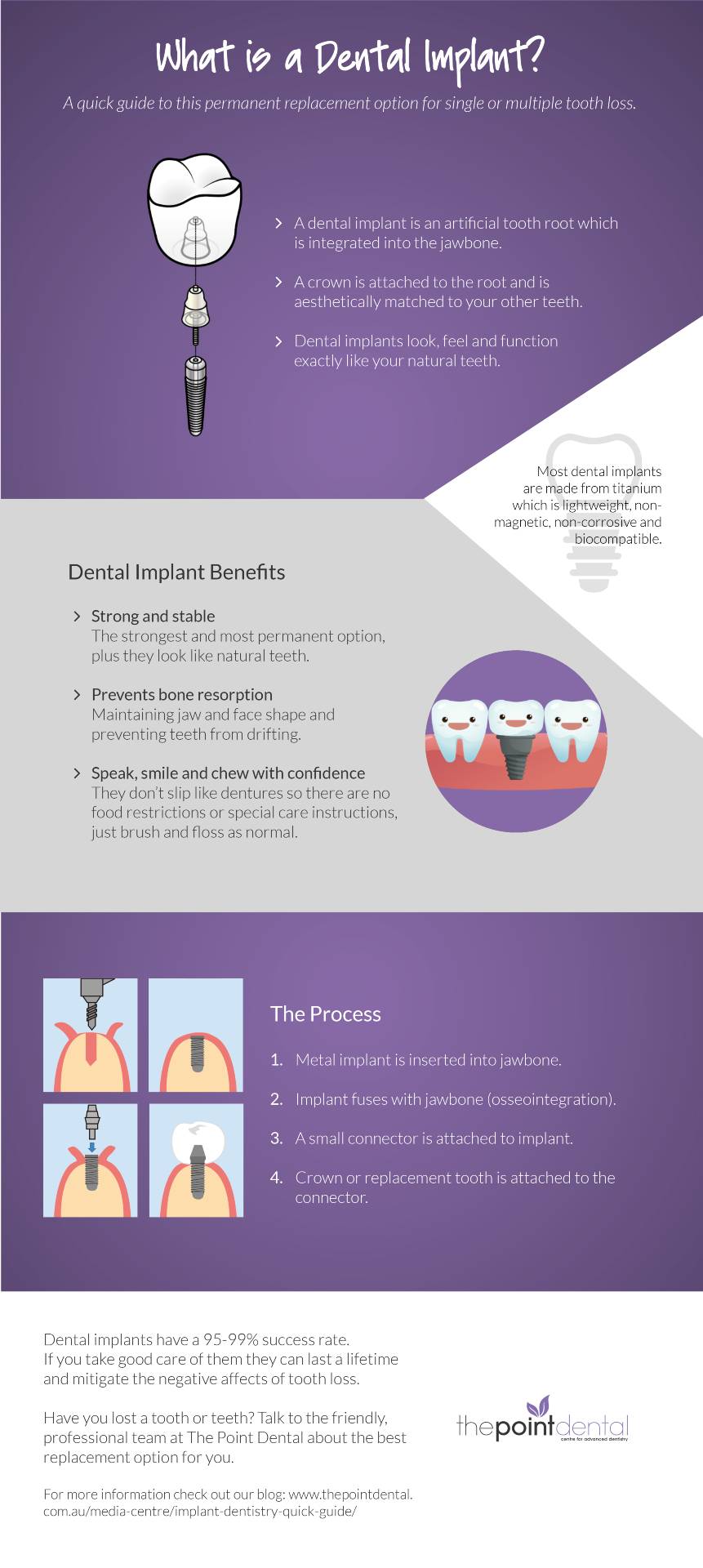 dental implant process infographic