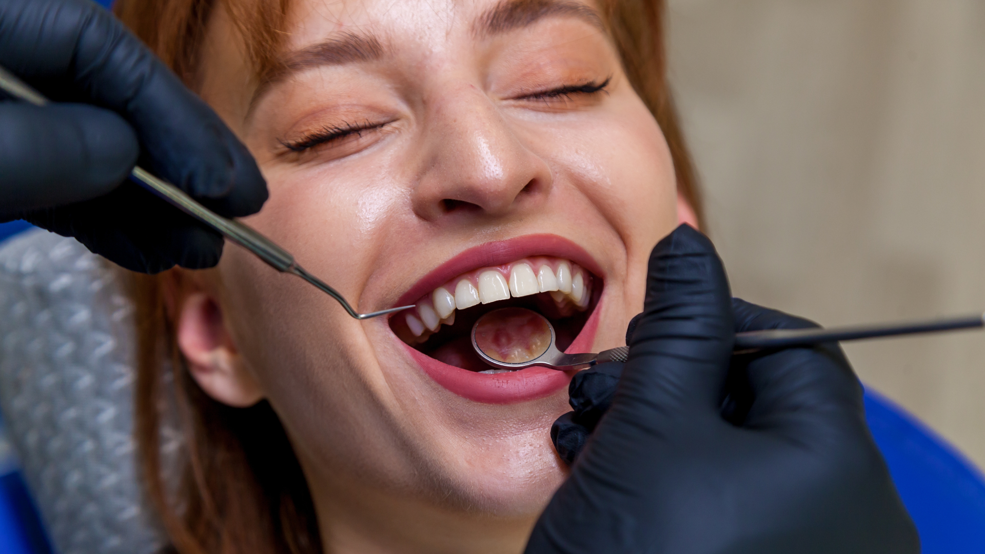 How long does dental bonding take?